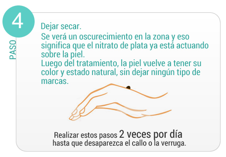 Paso 1